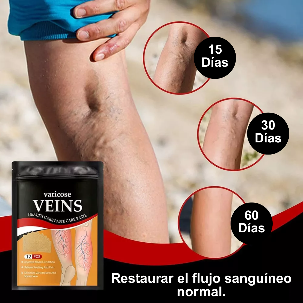 3 Pack Parches para Varices (Cada pack 12pcs)