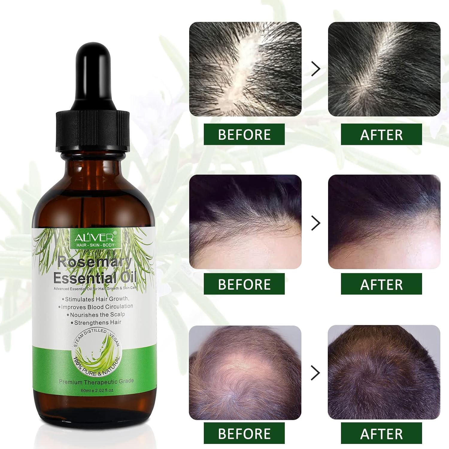 Aceite De Romero Crece Cabello