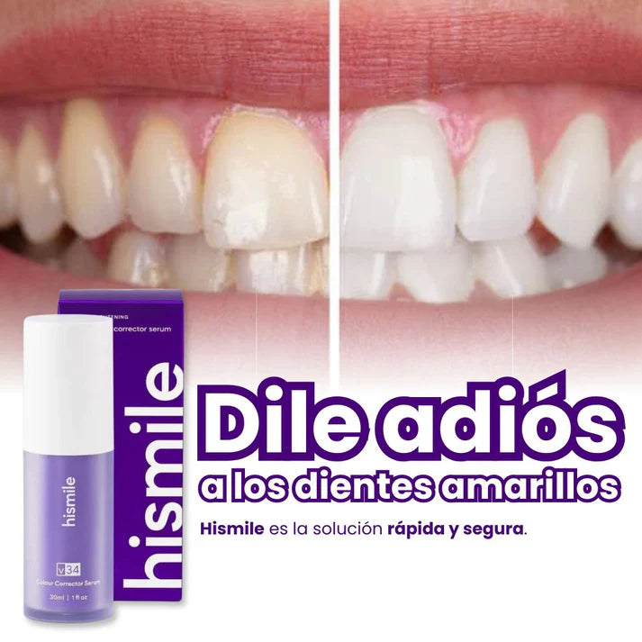 Blanqueador dental